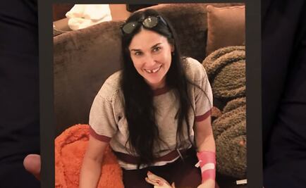 Demi Moore perdió dos dientes por estrés 
