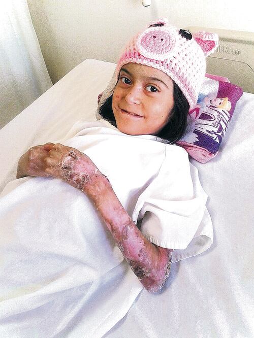 Antes de la operación, que tardó cinco horas, Purita fue sometida a una transfusión sanguínea debido a que presentaba bajos niveles de hemoglobina (EMILIO VÁSQUEZ. EL UNIVERSAL)