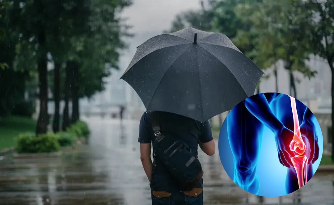 Los cambios en la presión atmosférica pueden ser los culpables de ese dolor articular que muchas personas sienten durante la temporada de lluvias.
Foto: EL Universal