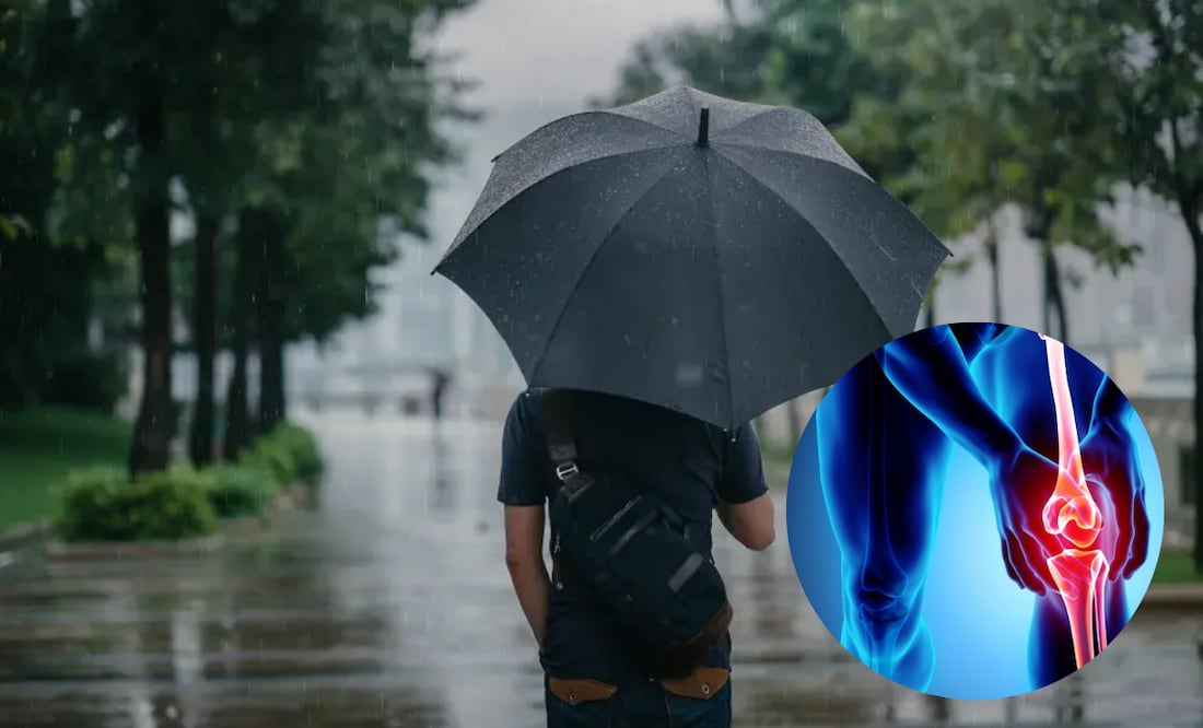 Los cambios en la presión atmosférica pueden ser los culpables de ese dolor articular que muchas personas sienten durante la temporada de lluvias.
Foto: EL Universal