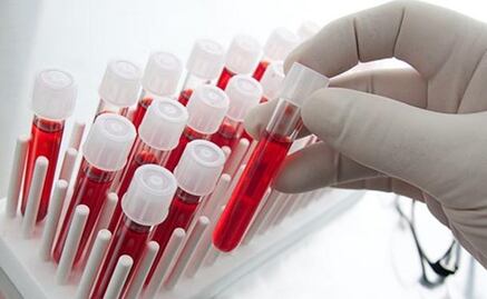 La biopsia líquida se suma a la medicina personalizada