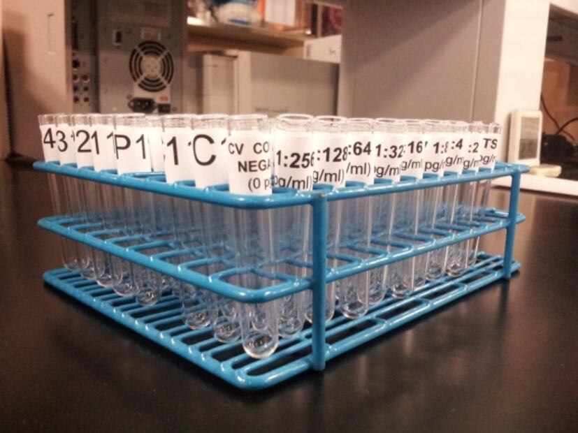 Científicos de la UNAM desarrollan pruebas en sangre para cáncer de pulmón