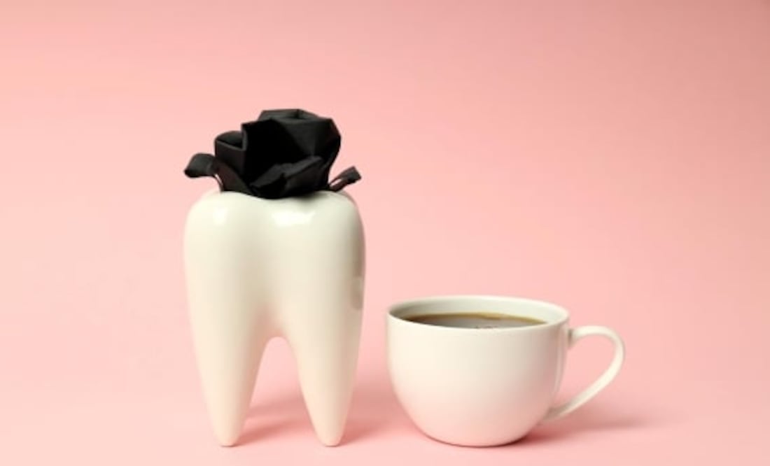 Aunque beber café tiene beneficios para la salud, una de las desventajas de su ingesta diaria es que poco a poco va manchando los dientes. Foto: Archivo / El Universal
