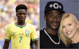 Vinícius Jr. se somete a una cirugía estética facial tras el Mundial 2026