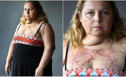 “Creía que yo era solo de él, nunca voy a olvidar cuando me roció con alcohol”