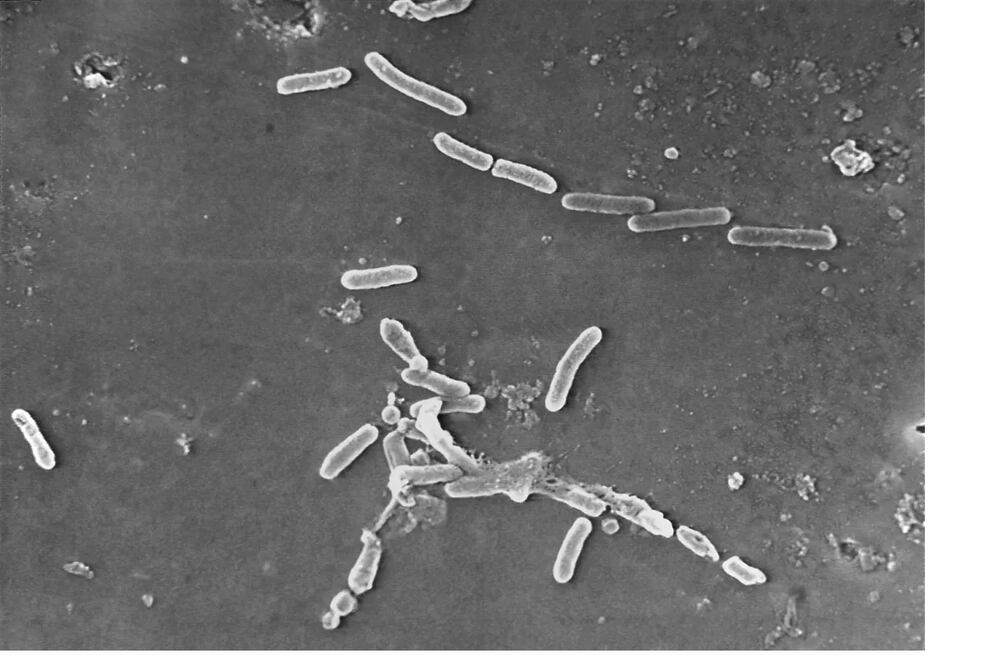 Imagen de microscopio electrónico proporcionada por los Centros para el Control y la Prevención de Enfermedades de Estados Unidos (CDC) que muestra la bacteria Pseudomonas aeruginosa. Suman tres muertes en EU relacionadas con el uso de gotas contaminadas. Foto: AP