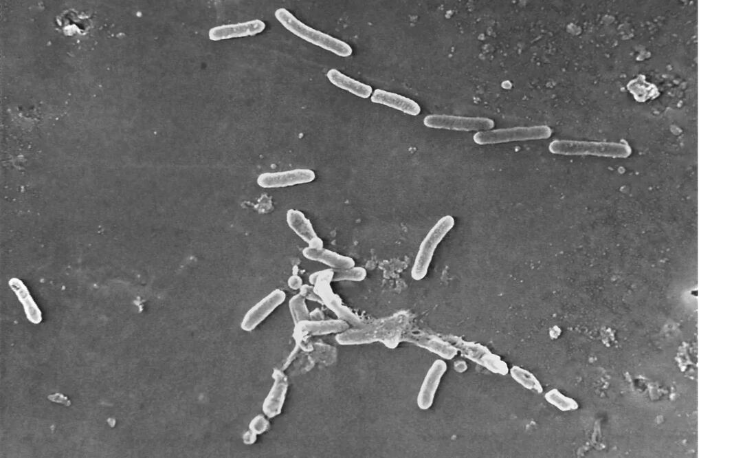 Imagen de microscopio electrónico proporcionada por los Centros para el Control y la Prevención de Enfermedades de Estados Unidos (CDC) que muestra la bacteria Pseudomonas aeruginosa. Suman tres muertes en EU relacionadas con el uso de gotas contaminadas. Foto: AP