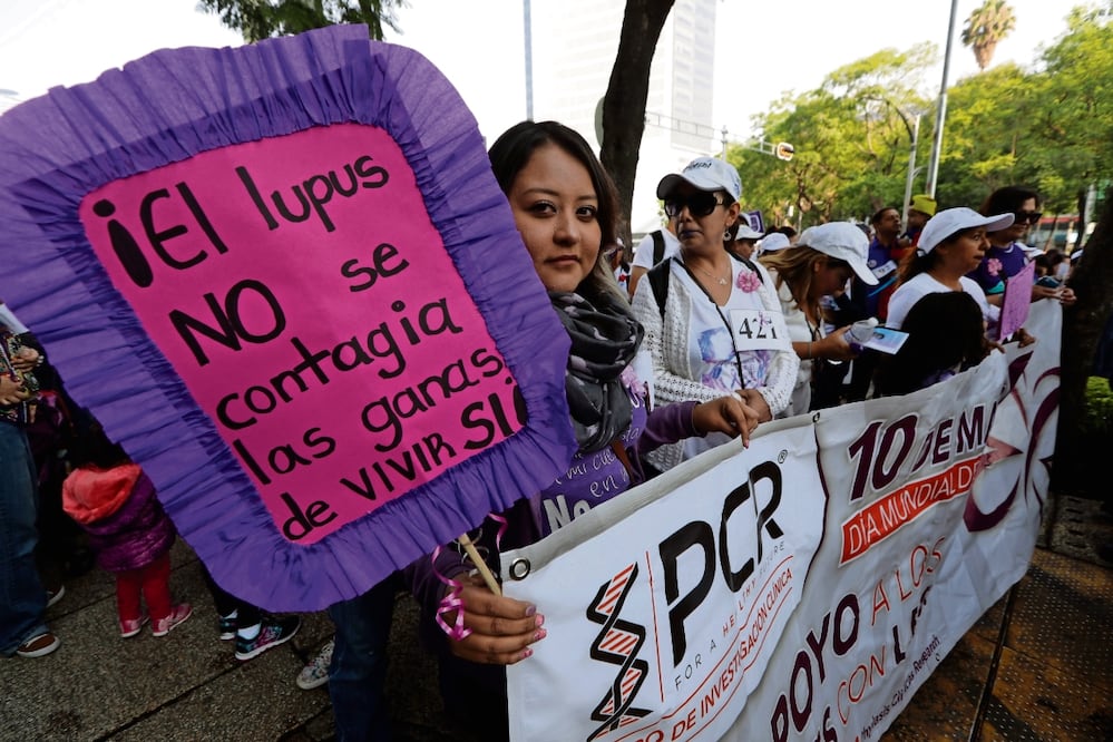 El lupus afecta a 200 personas por cada 100 mil habitantes; el 10 de mayo se conmemora la lucha contra esta enfermedad. Archivo El Universal