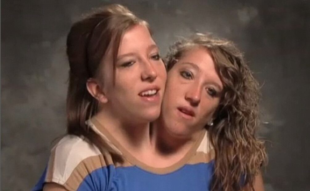 Foto: Instagram @abbyandbrittany