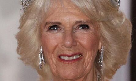 3 cirugías estéticas que se hizo Camilla Parker Bowles a días de su coronación