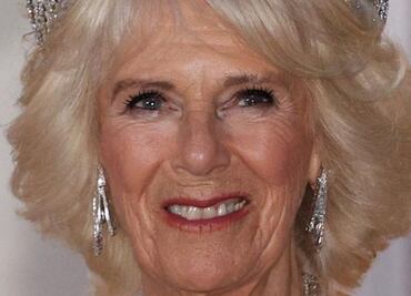 3 cirugías estéticas que se hizo Camilla Parker Bowles a días de su coronación