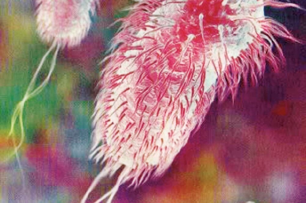 Bacterias Escherichia coli, vistas al micro scopio. Foto: ESPECIAL