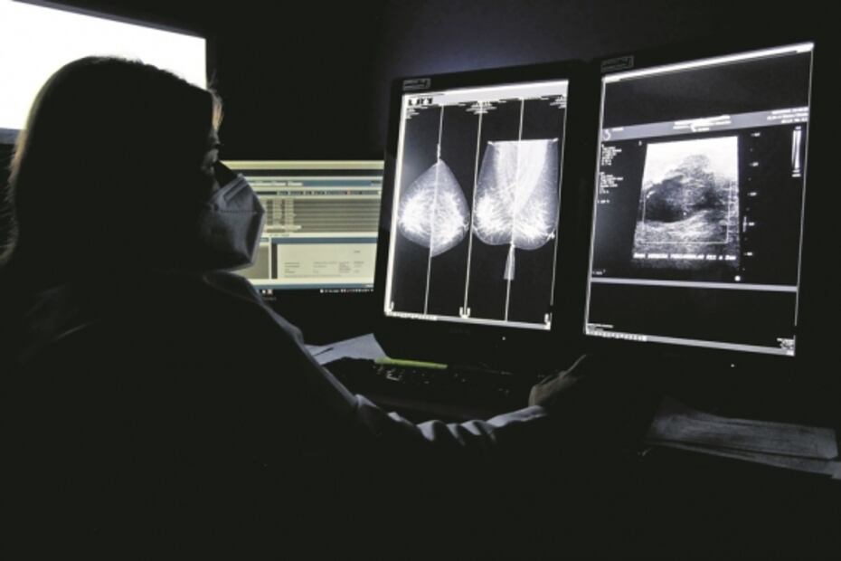 Cáncer de mama. Lorena muestra su cicatriz para invitar a las mujeres a que se exploren