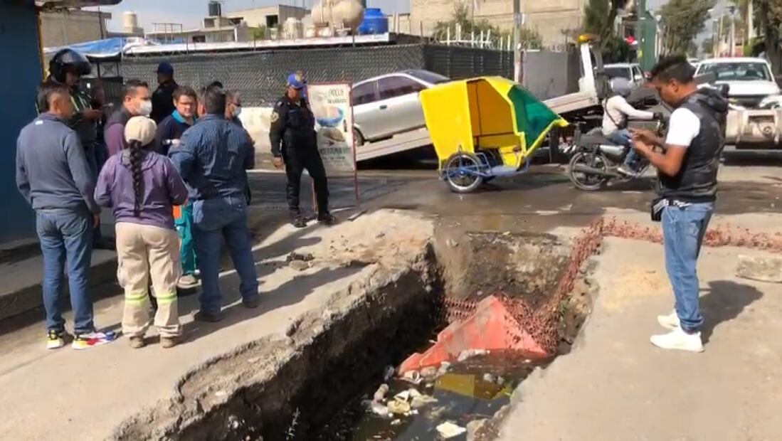 El afectado es Miguel Ángel Campos de 25 años. FOTO: Isidro Corro/ EL UNIVERSAL/