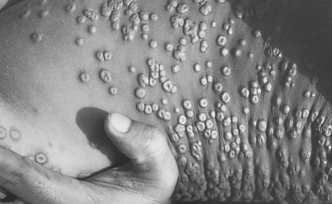 Foto: Getty Image vía BBC