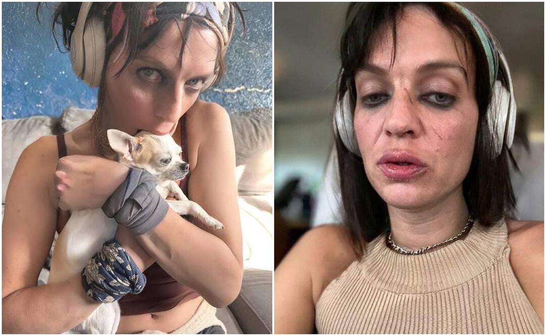 Camilo Blanes y sus preocupantes fotos en redes sociales.