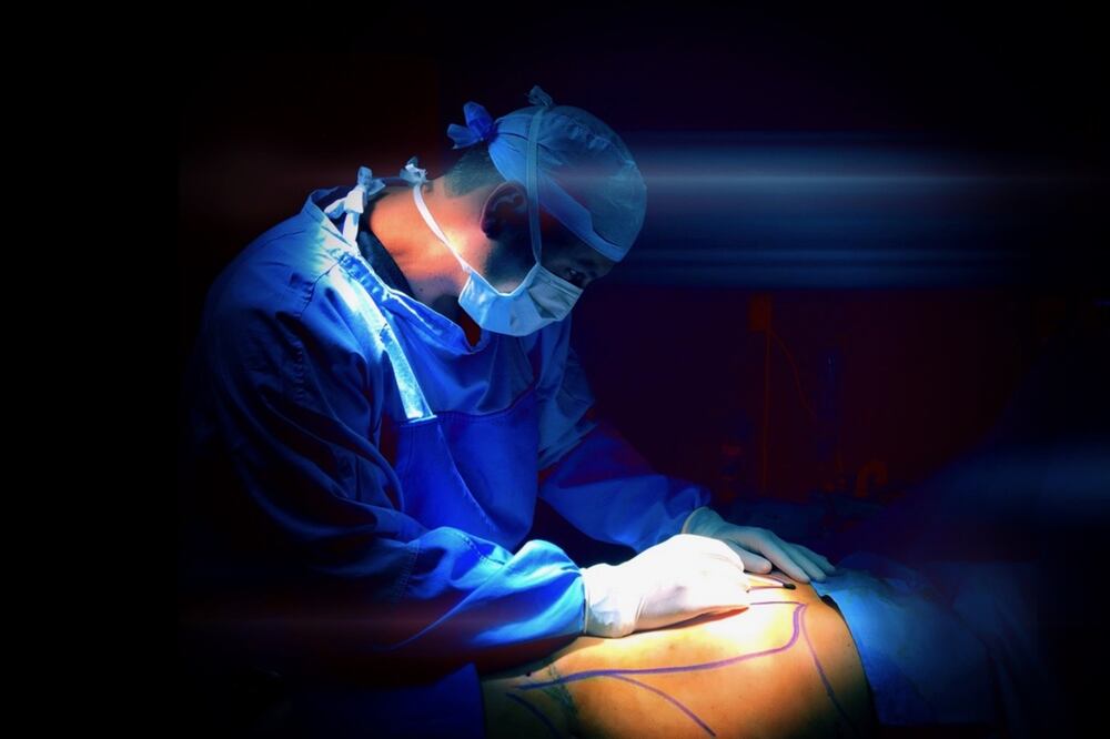 Intervención quirúrgica. Foto: El Universal, archivo
