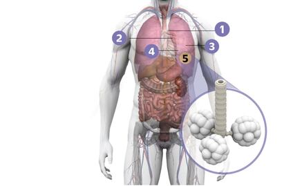 Descubren proteína relacionada con el cáncer de pulmón