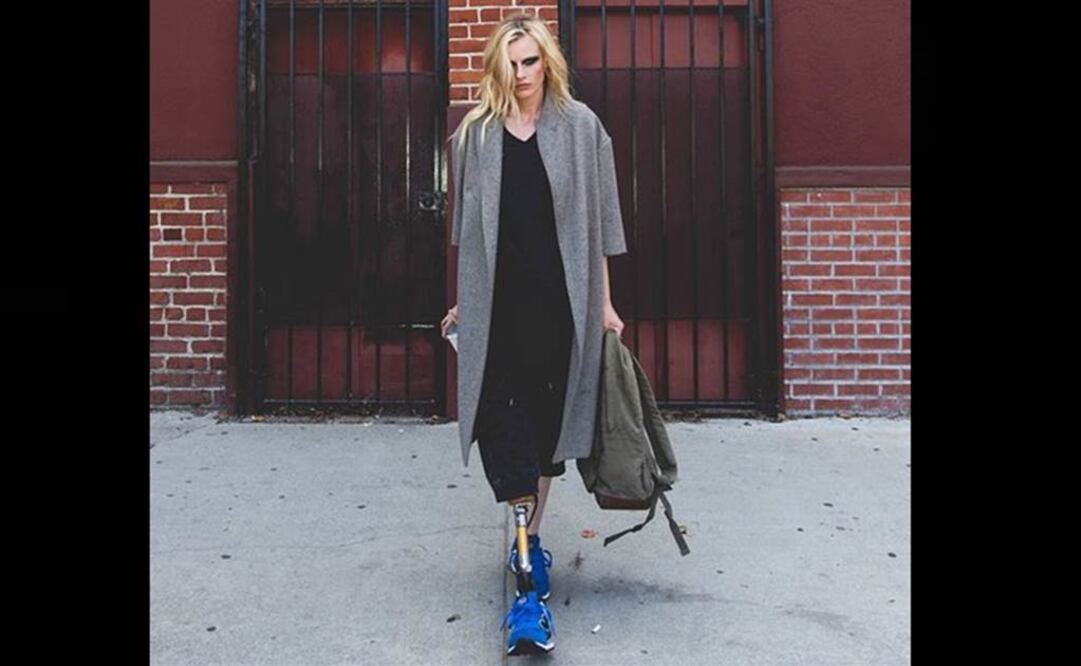 Caso de la modelo californiana Lauren Wasser le dio la vuelta al mundo. Foto: Instagram