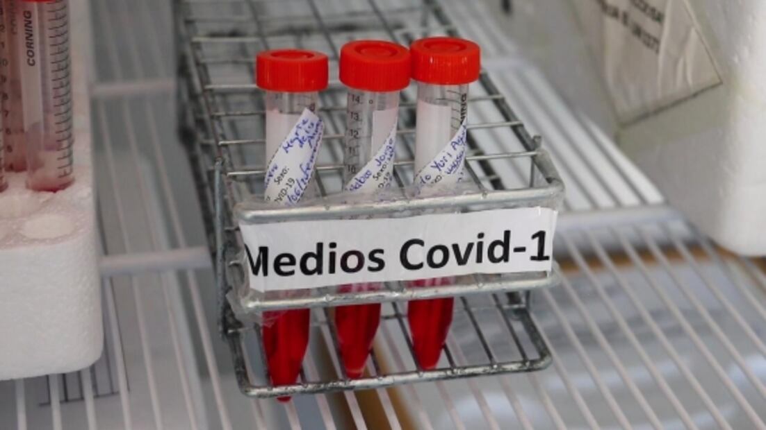 Laboratorio de Salud Pública en Edomex aplicará prueba que detectar influenza y Covid-19