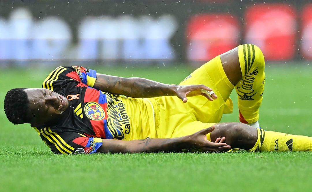 América revela gravedad de la lesión de Cristian Borja / Foto: Imago7