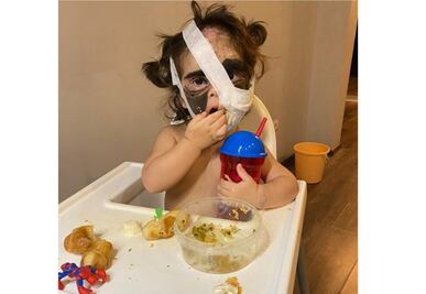 Luna, la niña que nació con la máscara de Batman en su rostro