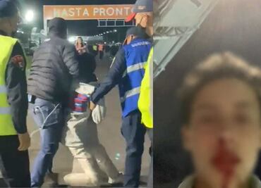 "¡Mamá, me acaba de partir la jeta el señor!"; denuncian agresión a menor en acceso a concierto de Dua Lipa