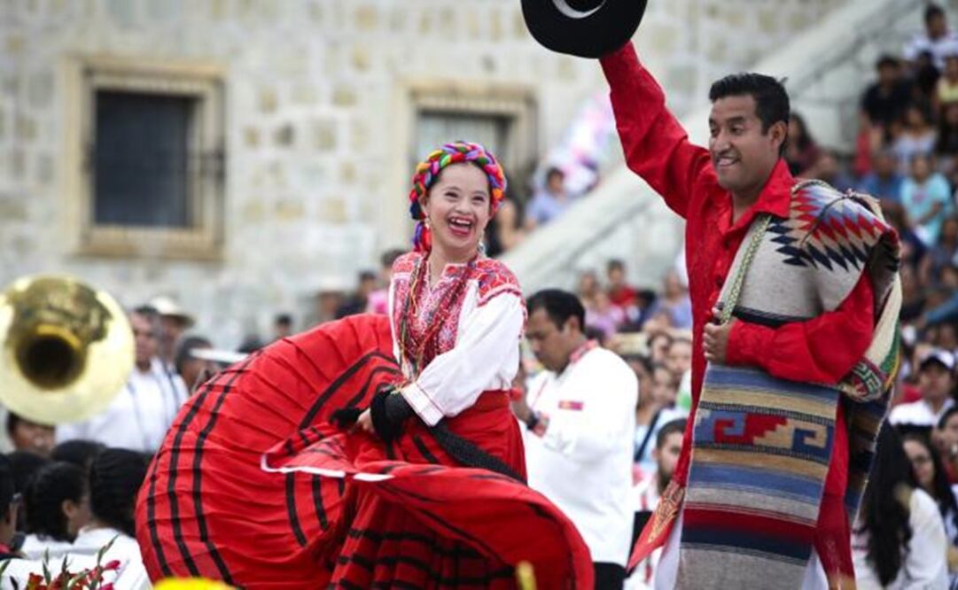 Las personas con Síndrome de Down tienen el derecho de vivir plenamente/ Foto: EL UNIVERSAL