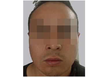 Condenan a 17 años de prisión a hombre que quemó las manos a su hijo