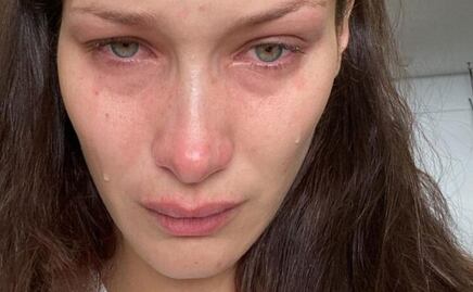 Bella Hadid se quiebra ante sus fans y habla de su lucha contra la ansiedad