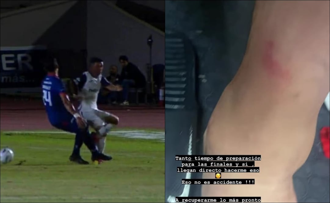 La dura lesión del Hobbit Bermúdez / Foto: Especiales