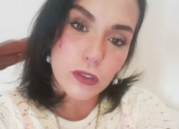 Mayela Laguna fue brutalmente golpeada en Acapulco; está hospitalizada