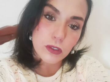 Mayela Laguna fue brutalmente golpeada en Acapulco; está hospitalizada