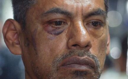 Activista LGBT+ denuncia tortura de policías de Santa Lucía del Camino, Oaxaca; fue privado de la libertad por 4 horas