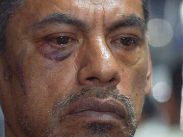 Activista LGBT+ denuncia tortura de policías de Santa Lucía del Camino, Oaxaca; fue privado de la libertad por 4 horas