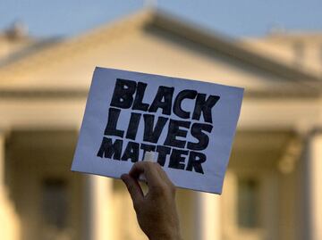 Racism is alive in the U.S. and the world