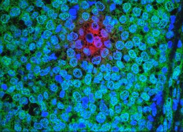 Identifican proteínas que podrían curar cánceres como la leucemia