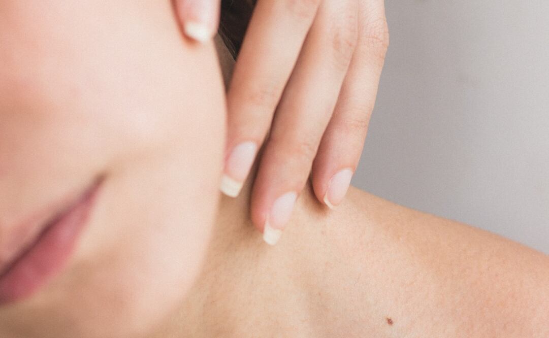 El agua oxigenada puede ser dañina para la piel, por ello debes tener cuidado. Foto: Unsplash