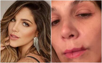 Natalia Alcocer muestra la violencia de su expareja: "Soy el anuncio de un feminicidio", advierte