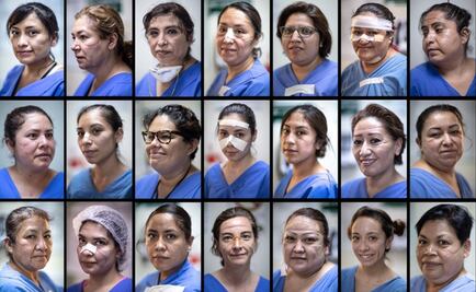 Photos show the bruised faces of Mexican female healthcare workers on the frontlines of coronavirus
