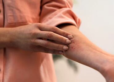 El fruto que crece al sur del continente y alivia irritaciones cutáneas; descubre sus secretos