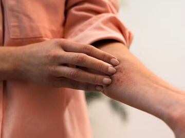 El fruto que crece al sur del continente y alivia irritaciones cutáneas; descubre sus secretos