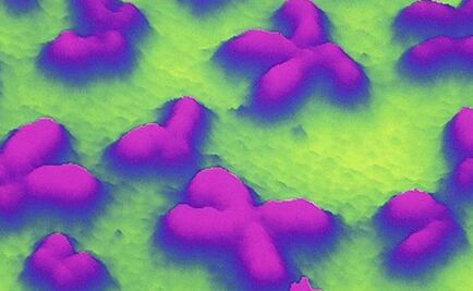Genes de síndrome de Down dan pistas sobre la diabetes tipo 2