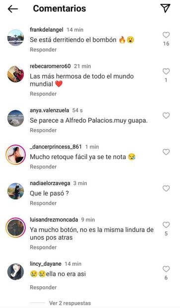 Ninel Conde sorprende con el volumen de sus labios: "se derrite el bombón", dicen cibernautas