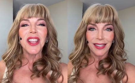 Laura Flores (62 años) impacta con radical cambio de look; redes la critican por ‘exceso’ de cirugías