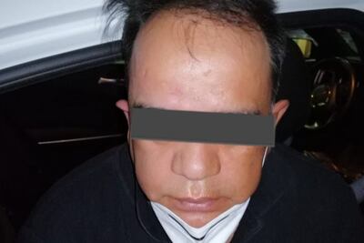 Detienen a sujeto que desfiguró con ácido el rostro de su pareja