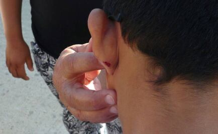 Reportan agresión de maestra a niño en Oaxaca