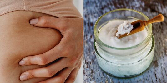 Cómo usar el aceite de coco para atenuar las estrías de la piel 