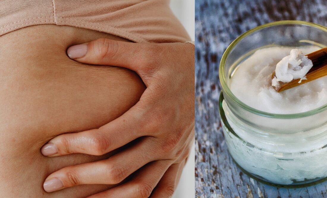 Ateuar las estrías en la piel es posible con ayuda del aceite de coco / Foto: Pexels