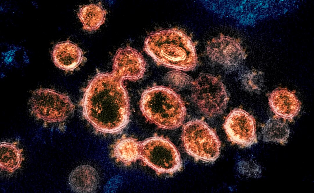 A través de un microscopio se observan partículas del coronavirus SARS-CoV-2, el cual provoca el Covid-19. Foto: NIAID-RML via AP